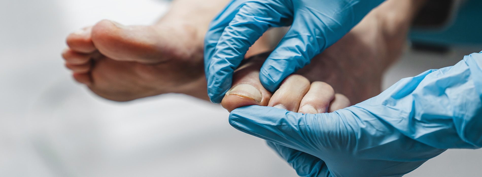 NY Foot and Ankle Clinic | Reconstructive Rear Foot Surgery, Ankle Foot Fractures and Sprains and Wound Care