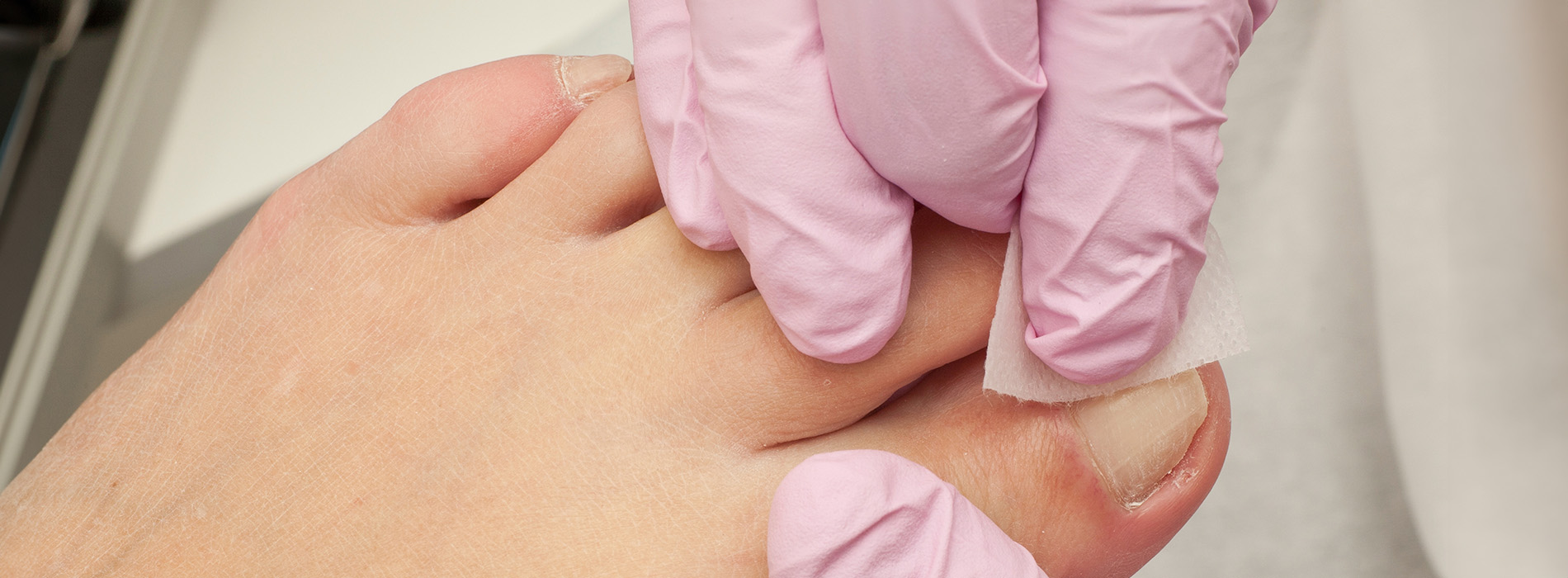 NY Foot and Ankle Clinic | Neuromas, Ankle Stability and Arthritic Foot   Ankle Care