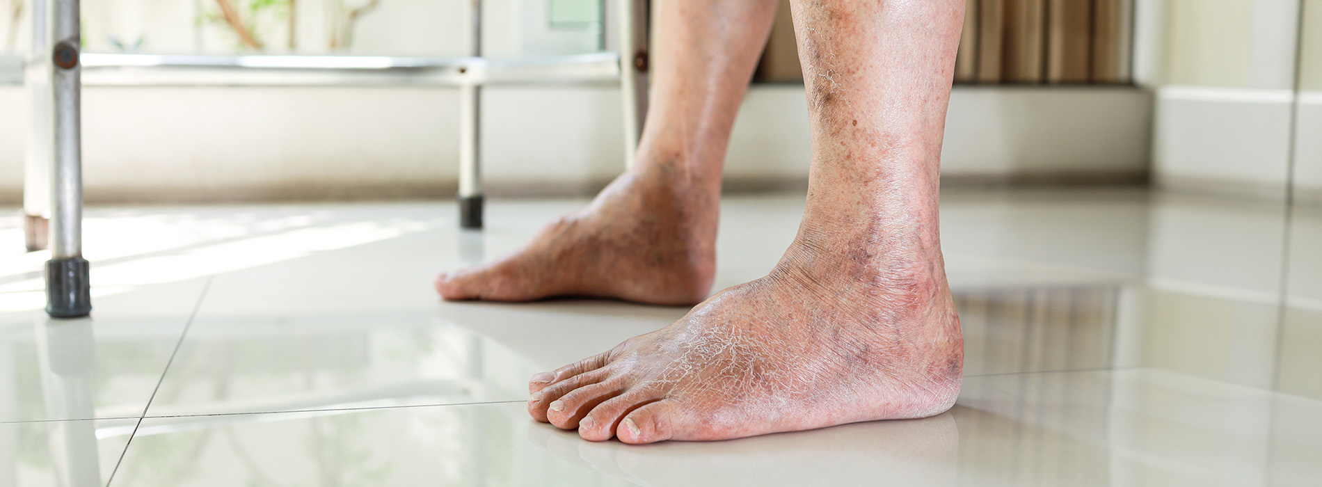 NY Foot and Ankle Clinic | Reconstructive Rear Foot Surgery, Diabetic Foot Care and Cosmetic Foot Surgery