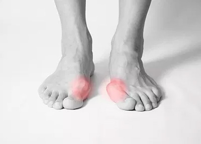 NY Foot and Ankle Clinic | Brachymetatarsia, Ankle Arthroscopy and Hammertoes