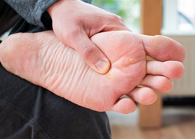 NY Foot and Ankle Clinic | Brachymetatarsia, Ankle Arthroscopy and Ankle Foot Fractures and Sprains