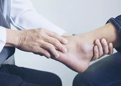 NY Foot and Ankle Clinic | Brachymetatarsia, Reconstructive Rear Foot Surgery and Bunions